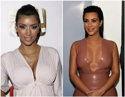 Ким Кардашьян: фото до и после пластики