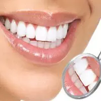 Наращивание зубов - до и после