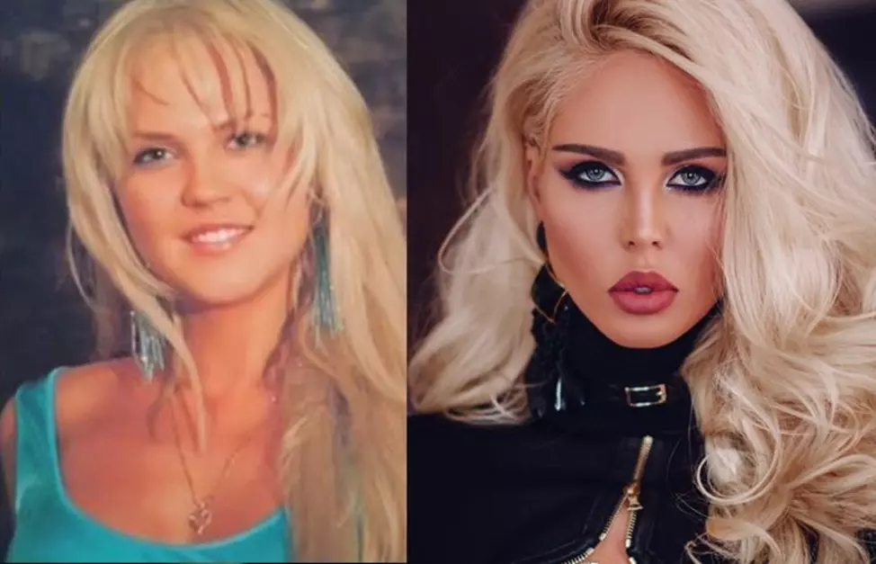 Мария Погребняк до и после пластики, как выглядит сейчас жена футболиста