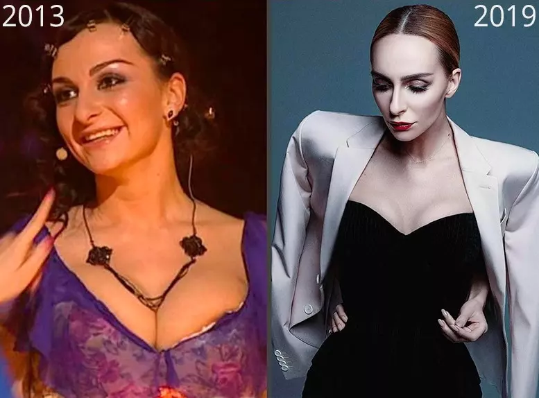 Фигура Екатерины Варнавы до и после пластической хирургии