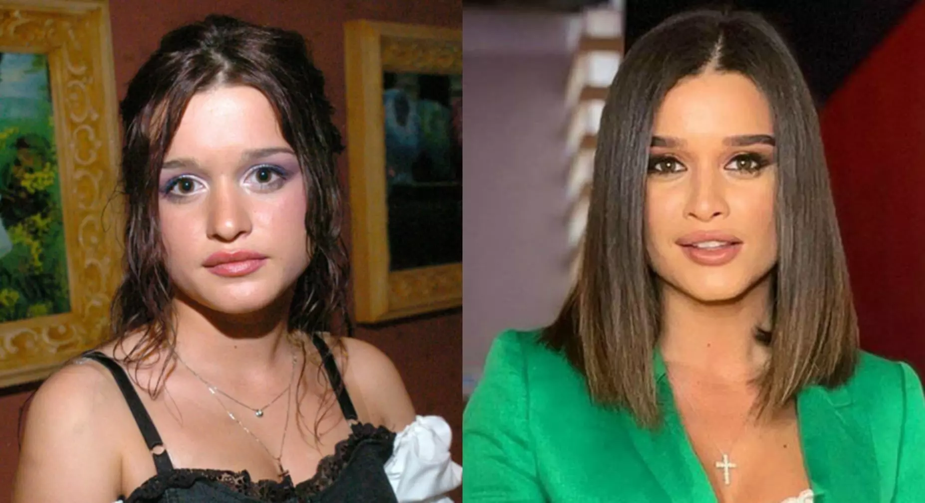 Ксения бородина в молодости фото до и после пластики