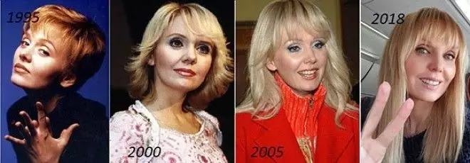 Фото до и после пластики Валерии, как выглядит сейчас певица в 2023 году