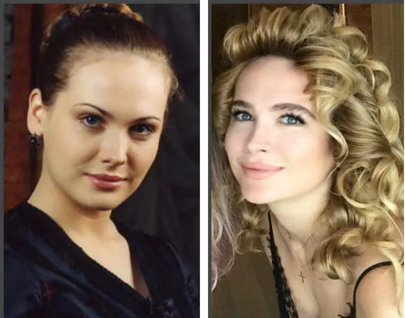 https://infoplastika.ru/images/cms/data/foto-zvezd/anna-gorchkova/5-anna-gorshkova-plastika.jpg