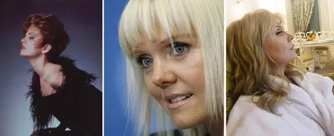 Фото до и после пластики Валерии, как выглядит сейчас певица в 2023 году