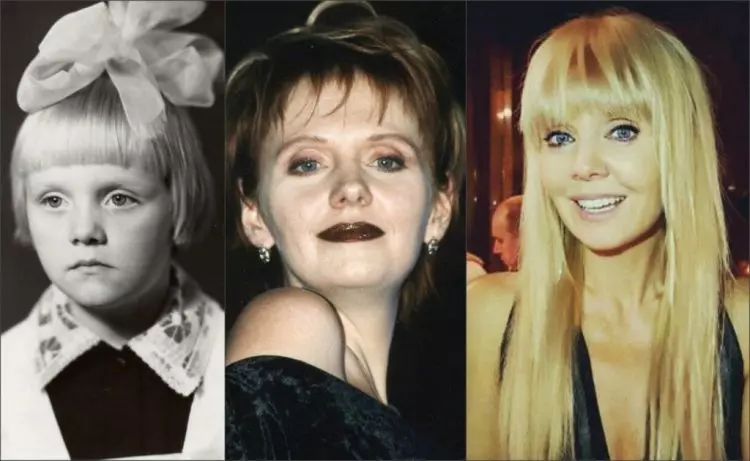 Вачевских сестры до и после фото