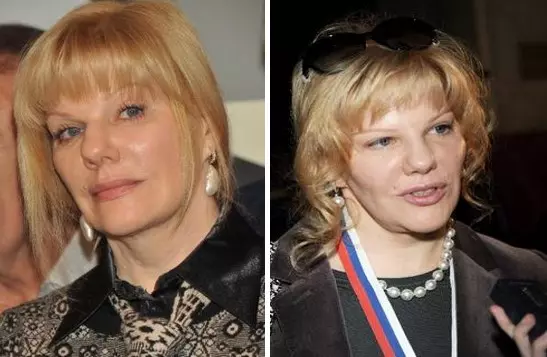 Александра Захарова до и после пластики