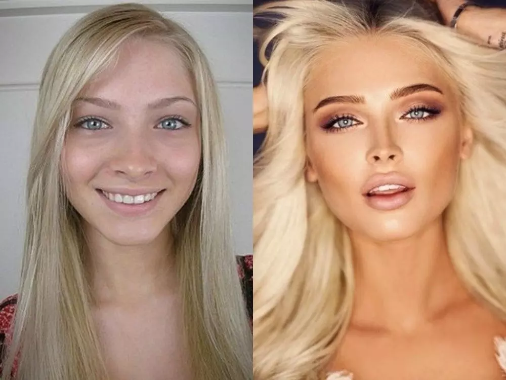 Дочь маслякова младшего пластика фото до и после