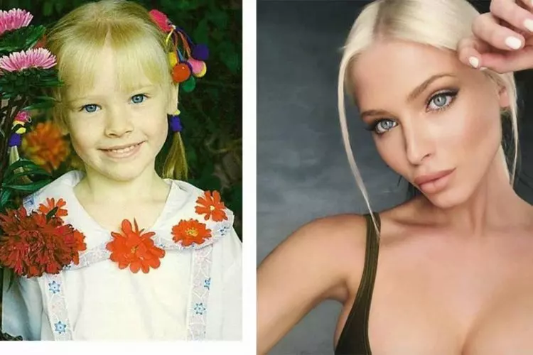 Алена Шишкова до и после пластики фото, как выглядит