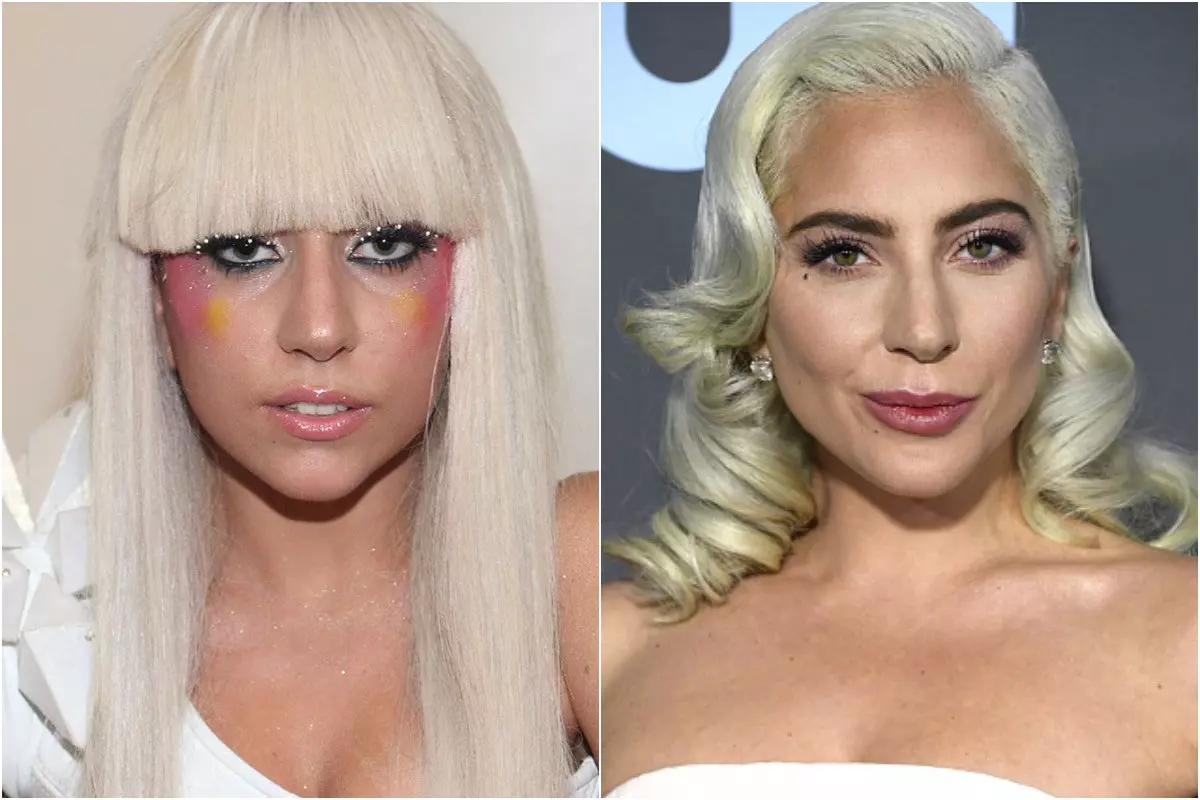 Леди Гага до и после пластики