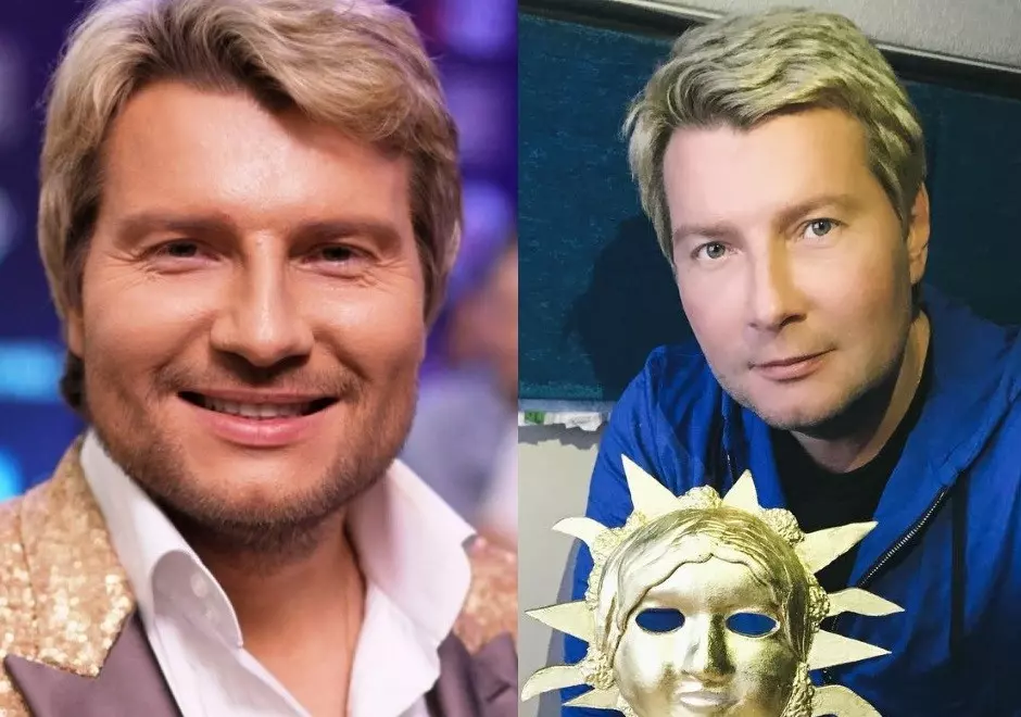 Как выглядит Николай Басков до и после пластики и что стало причиной коррекции внешности