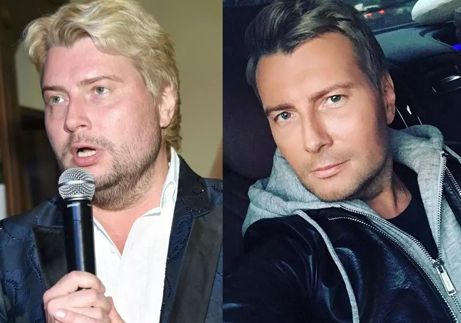 Как выглядит Николай Басков до и после пластики и что стало причиной коррекции внешности