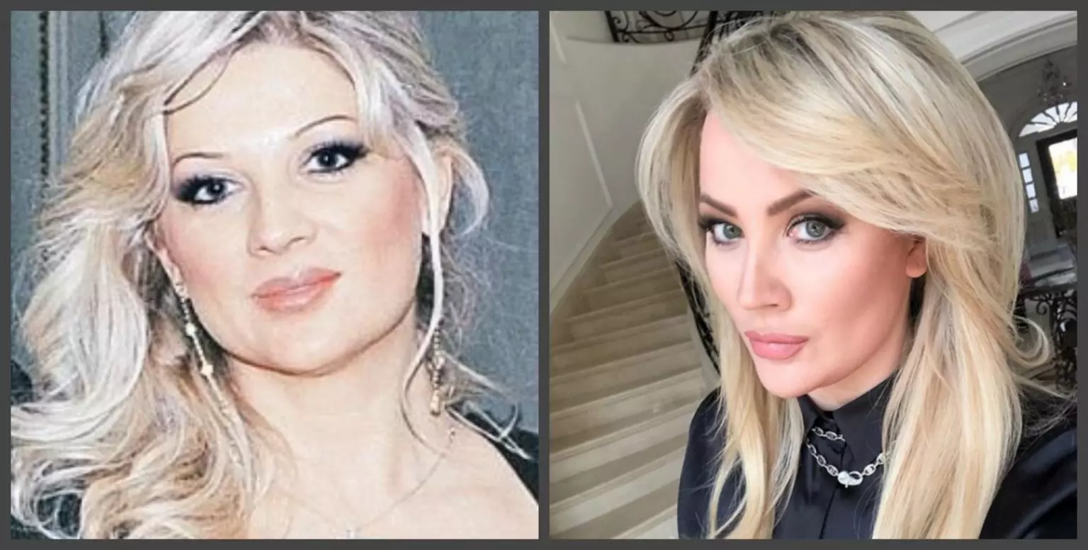 Жена стаса михайлова до и после пластики фото возраст
