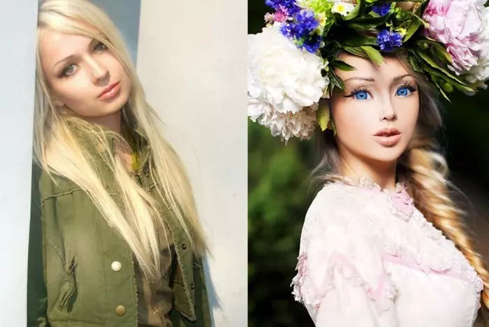 Валерия Лукьянова до и после пластики: как выглядит Барби в 2023 году