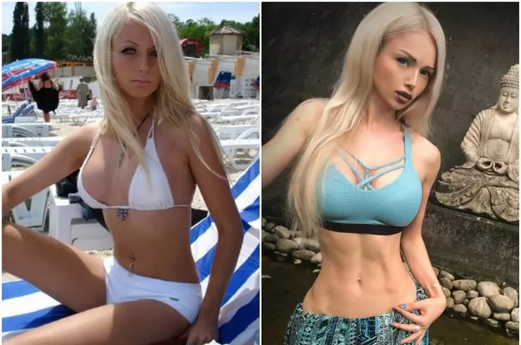 Валерия Лукьянова до и после пластики: как выглядит Барби в 2023 году