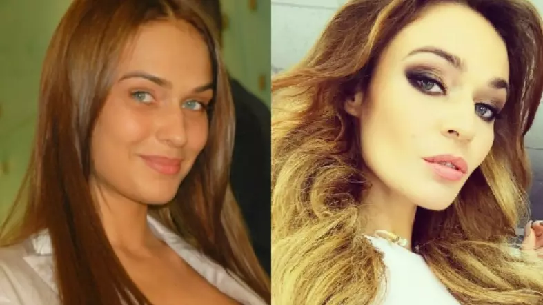 Алёна Водонаева до и после пластики